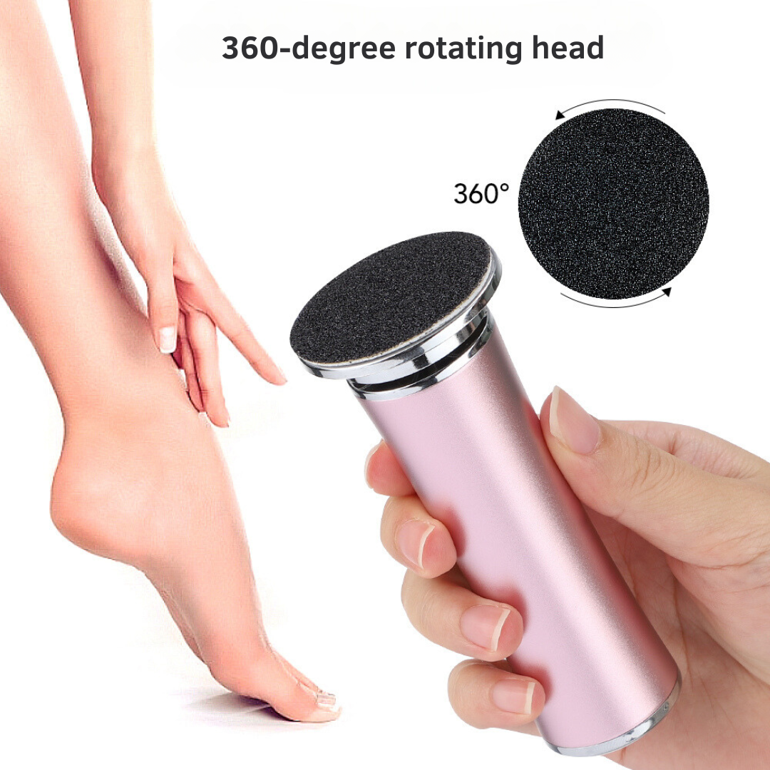 SoftStep™ - Electric Callus Remover